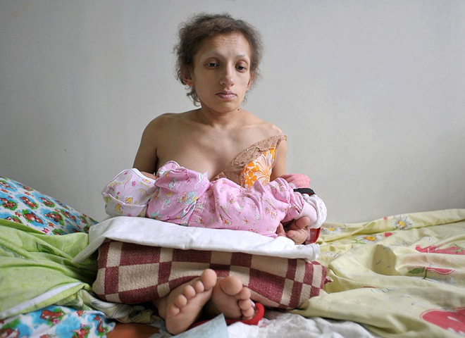 25 вересня у Червонограді померла найнижча мама в країні – 36-річна Марія Українець
