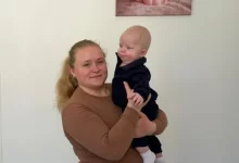 У Центрі дитячої медицини прооперували немовля з рідкісною кишковою патологією
