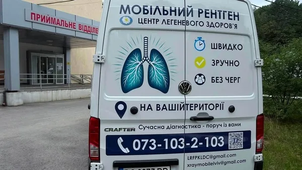 Рентгенмобіль Центру легеневого здоров’я обстежуватиме мешканців громад Львівщини у липні
