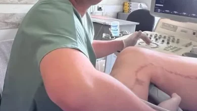 Львівські хірурги зберегли ногу пацієнту завдяки малоінвазивному втручанню