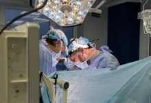 У Львові видалили рідкісний паразит, що роками руйнував печінку жінки