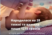 Історія передчасно народженої Анни у львівській Клініці матері та дитини