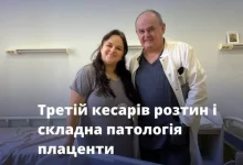 У «Клініці мати та дитина» зберегли матку 27-річній жінці під час третього кесаревого розтину