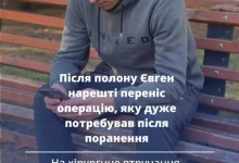 28-річному військовому з Львівщини після полону провели складну операцію на щелепі