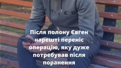 28-річному військовому з Львівщини після полону провели складну операцію на щелепі